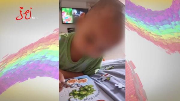 脑袋被打的疼会怎么样(怎么样才能让脑袋不疼)(图3)