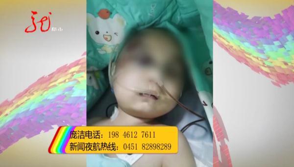 脑袋被打的疼会怎么样(怎么样才能让脑袋不疼)(图5)