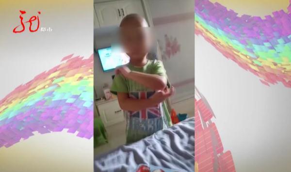 脑袋被打的疼会怎么样(怎么样才能让脑袋不疼)(图4)